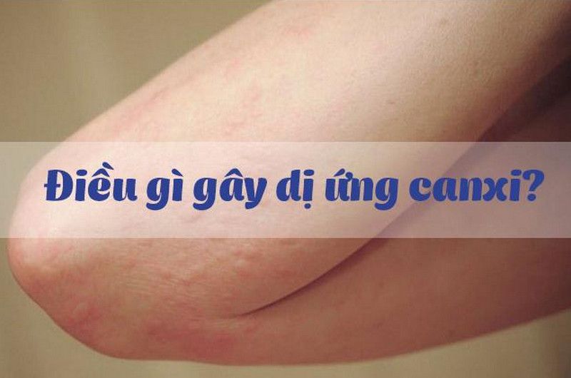 Nguyên nhân gây dị ứng canxi